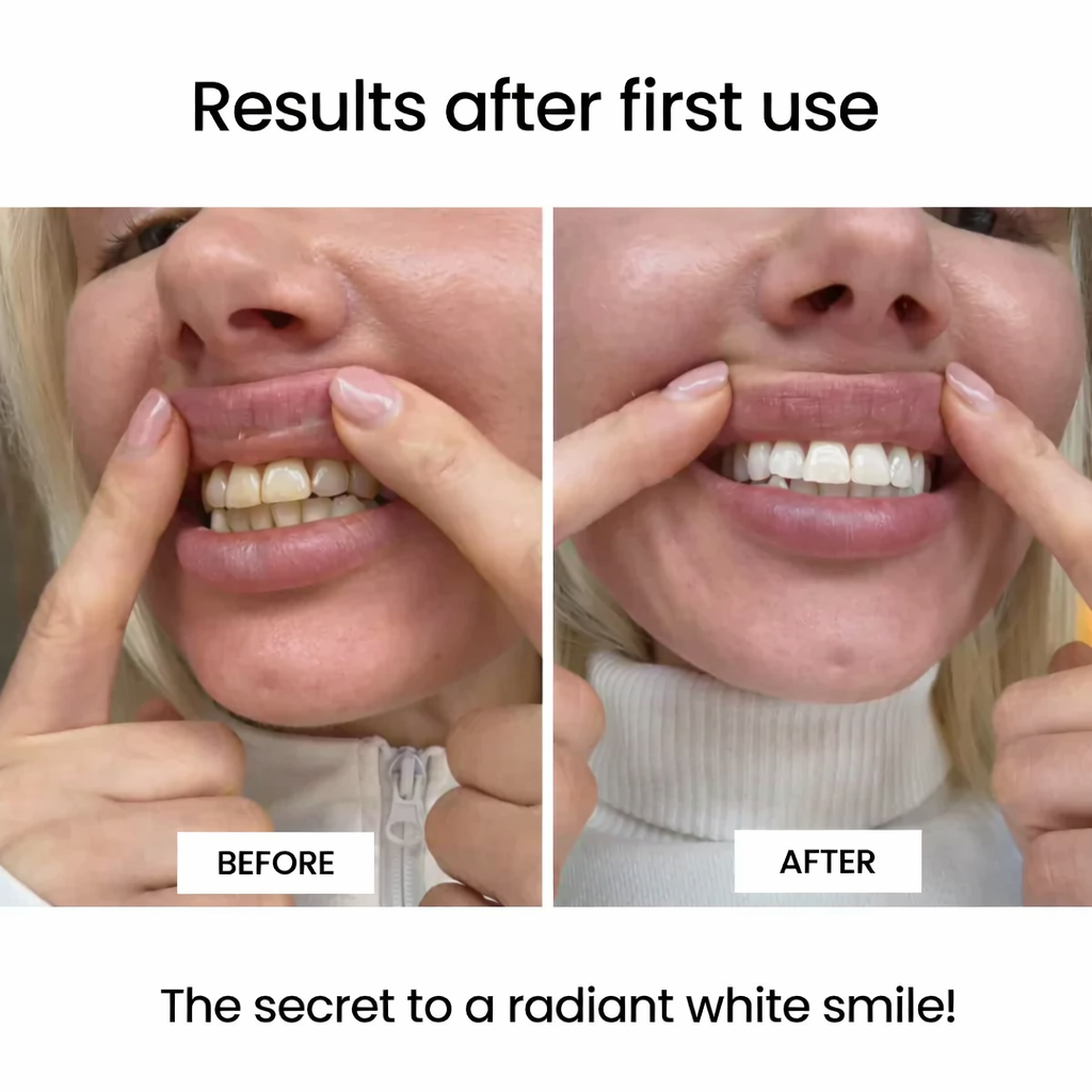 LOVILDS® | Whitening Strips