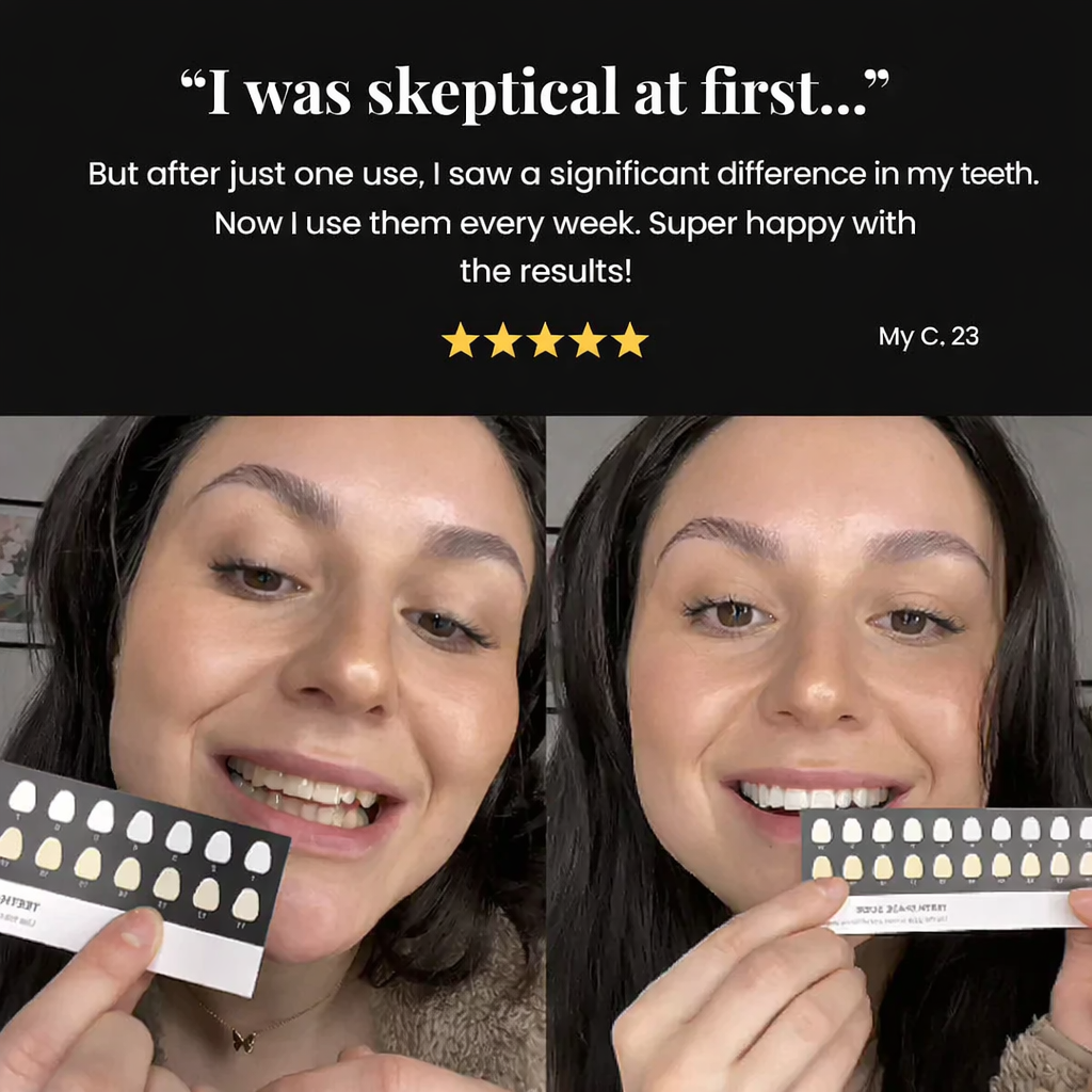 LOVILDS® | Whitening Strips