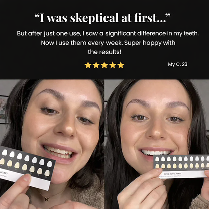 LOVILDS® | Whitening Strips